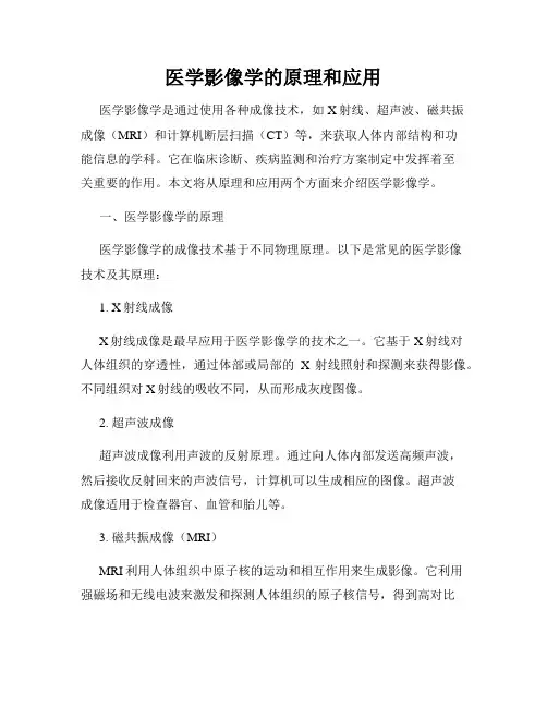 医学影像学的原理和应用