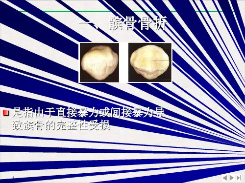 骨伤科护理学之下肢骨折PPT课件