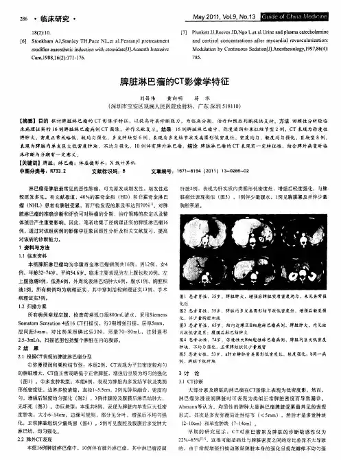 脾脏淋巴瘤的CT影像学特征