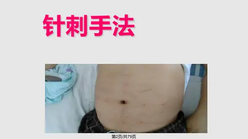 针刺手法学习.pptx