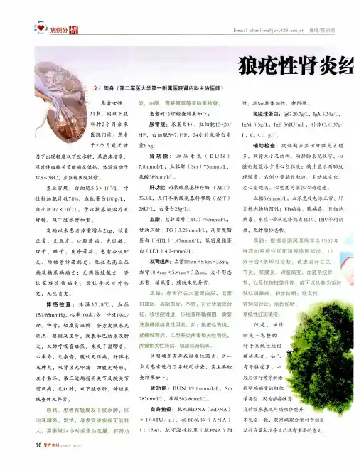 狼疮性肾炎经典病例分析