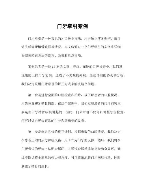 门牙牵引案例