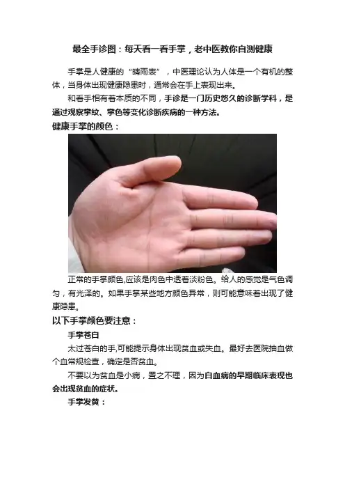 最全手诊图：每天看一看手掌，老中医教你自测健康