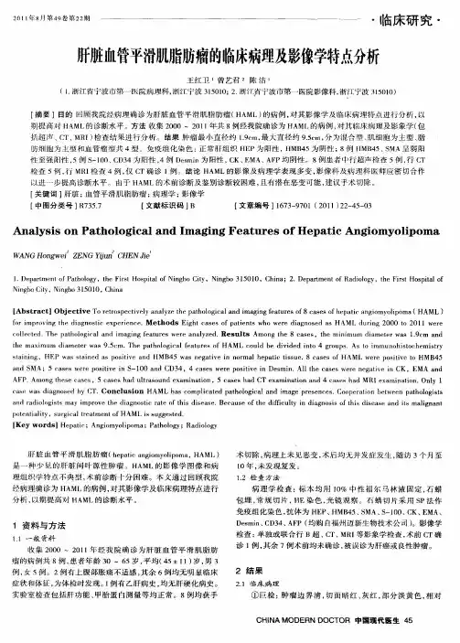 肝脏血管平滑肌脂肪瘤的临床病理及影像学特点分析