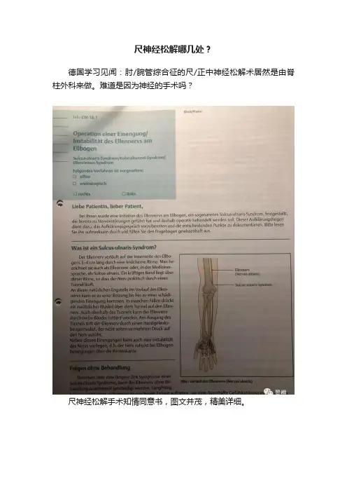 尺神经松解哪几处？