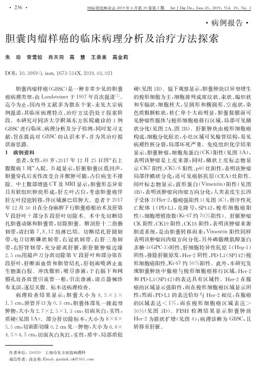 胆囊肉瘤样癌的临床病理分析及治疗方法探索