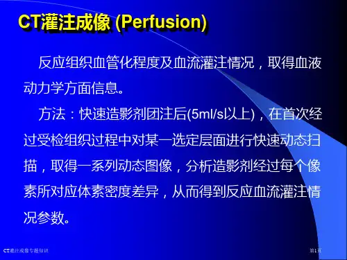 CT灌注成像专题知识