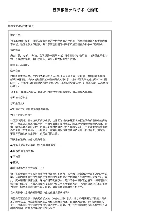 显微根管外科手术（病例）