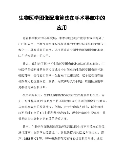 生物医学图像配准算法在手术导航中的应用