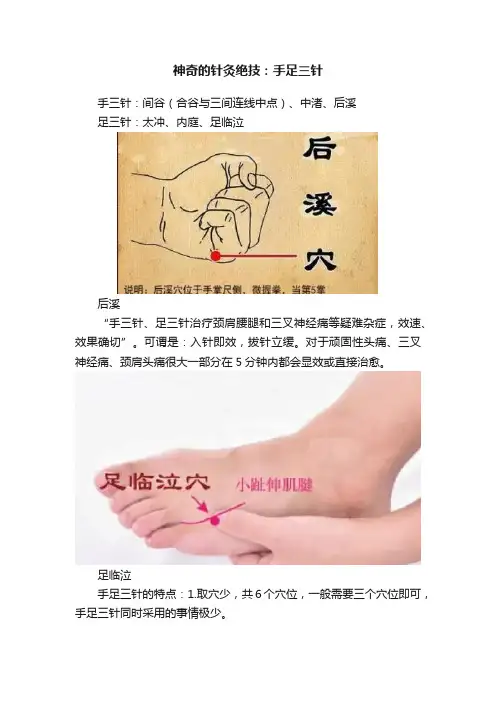 神奇的针灸绝技：手足三针