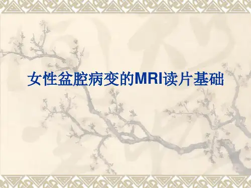 女性生殖系统核磁共振(MRI)读片基础
