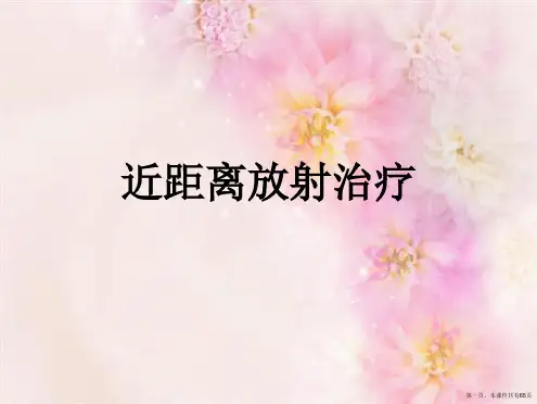 近距离放射治疗 (2)2