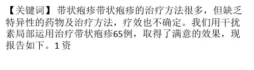 干扰素局部运用治疗带状疱疹