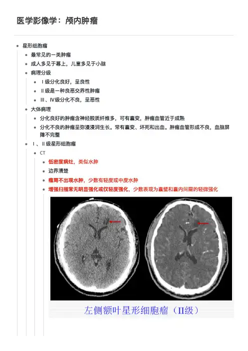 医学影像学：颅内肿瘤  学习笔记