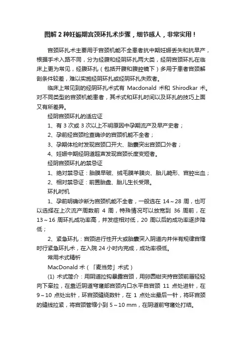 图解2种妊娠期宫颈环扎术步骤，细节感人，非常实用！