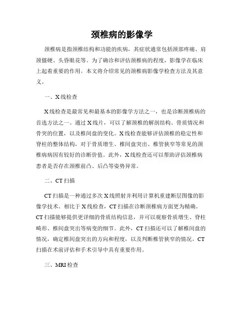 颈椎病的影像学