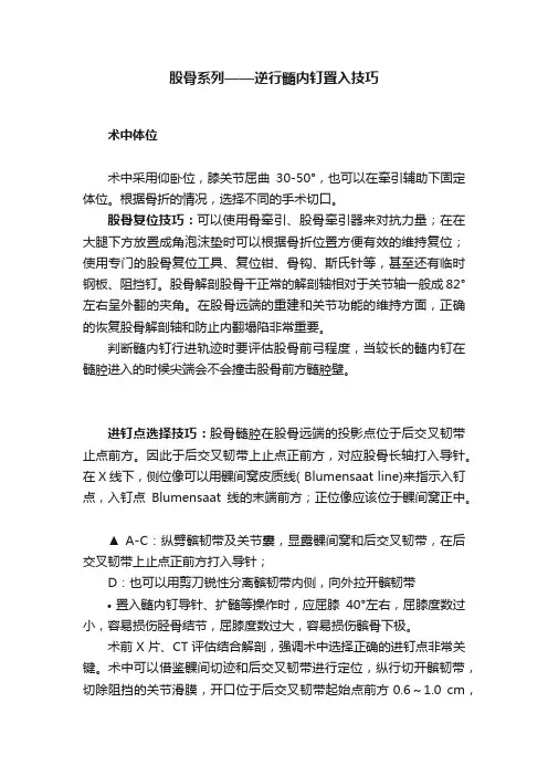 股骨系列——逆行髓内钉置入技巧