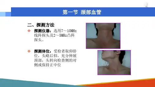 颈部血管超声探测技术 颈部血管超声探测方法