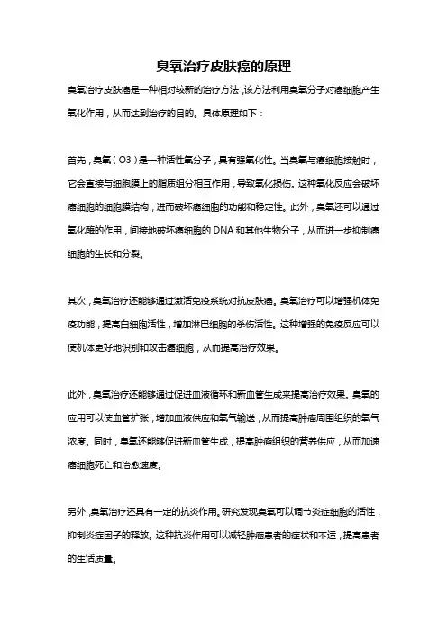 臭氧治疗皮肤癌的原理