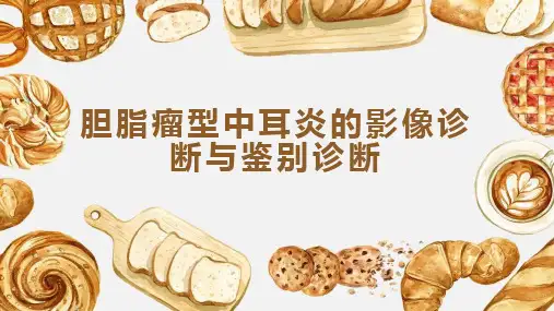 胆脂瘤型中耳炎的影像诊断与鉴别诊断
