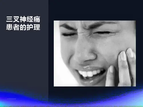 叉神经痛患者的护理