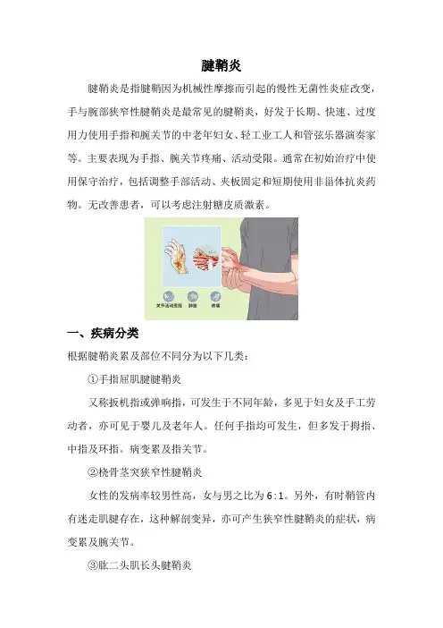 腱鞘炎(最全)