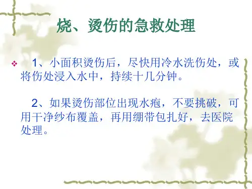 烧烫伤的急救处课件