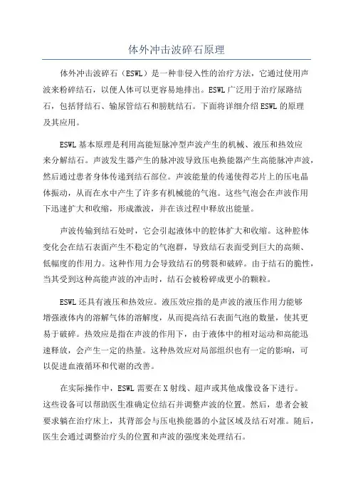 体外冲击波碎石原理