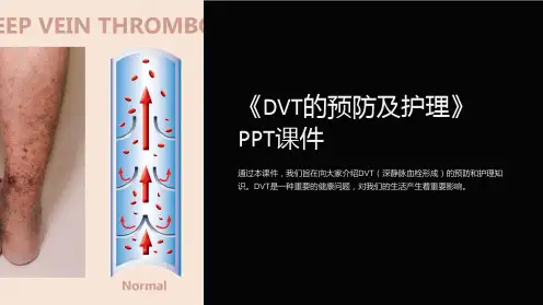 《dvt的预防及护理》课件