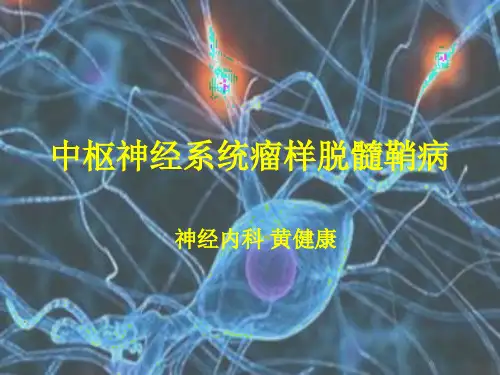 中枢神经系统瘤样脱髓鞘病变