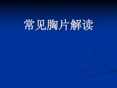胸片阅读