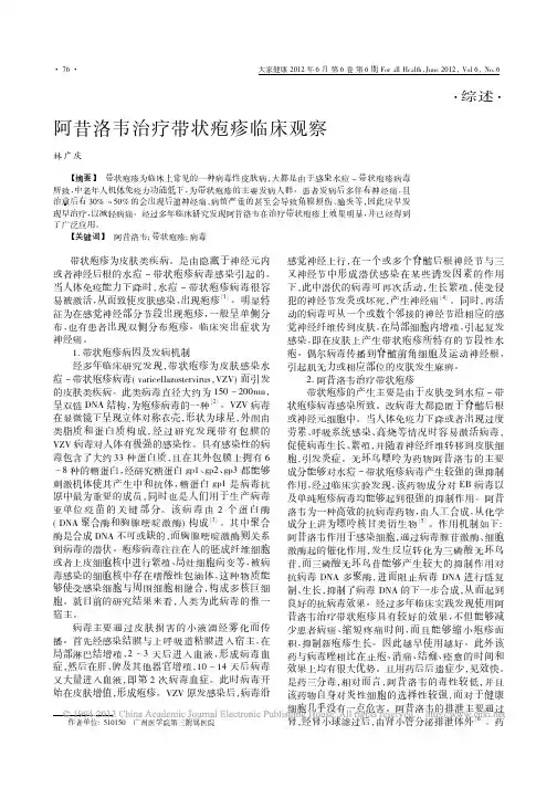 阿昔洛韦治疗带状疱疹临床观察