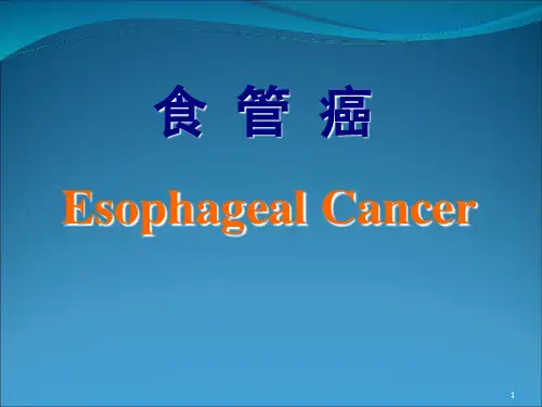 食管癌PPT演示幻灯片