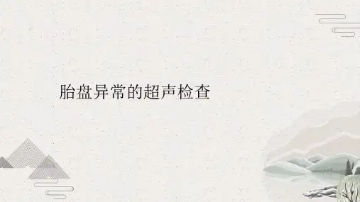 胎盘异常的超声检查