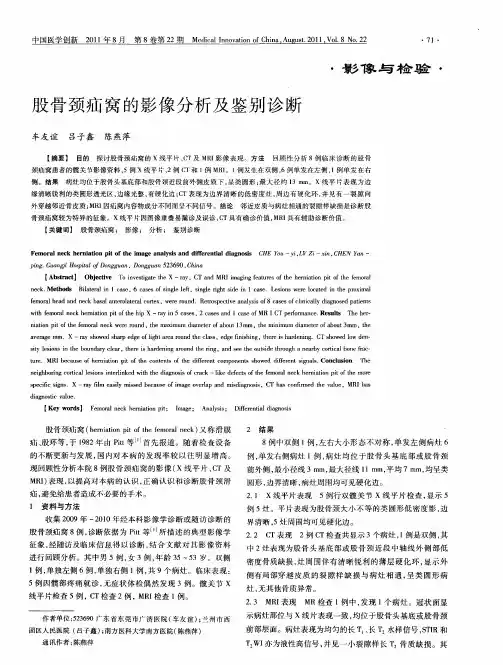 股骨颈疝窝的影像分析及鉴别诊断