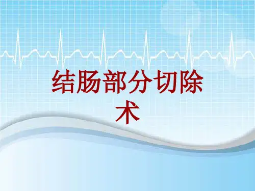 手术讲解模板：结肠部分切除术