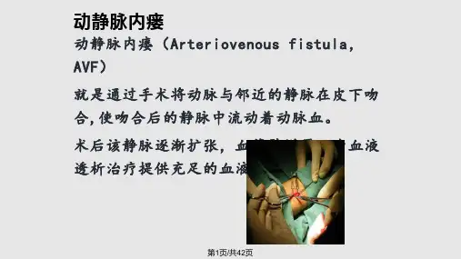 动静脉内瘘栓塞的原因分析及干预措施PPT课件