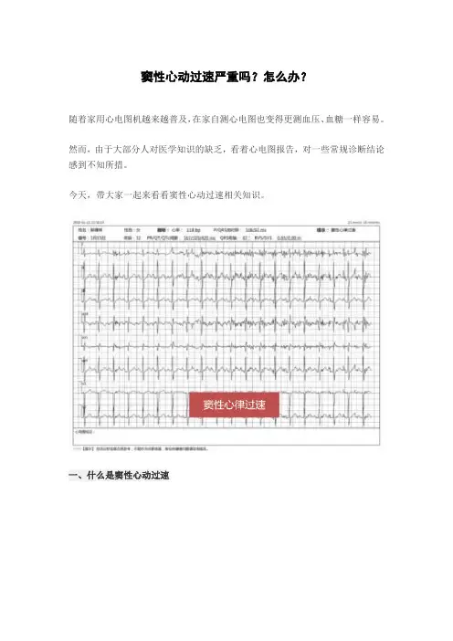 窦性心动过速严重吗？怎么办？