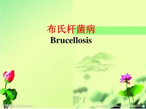 布氏杆菌病PPT课件