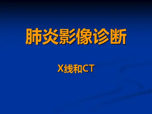 肺炎影像诊断培训课件