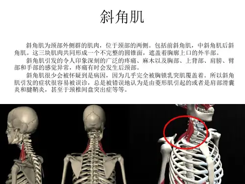 斜角肌解剖与痛点分析