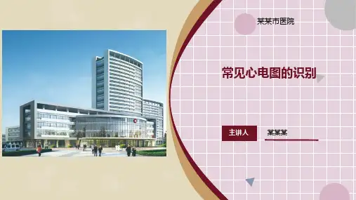 护理常见心电图识别