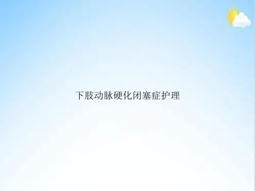 下肢动脉硬化闭塞症护理
