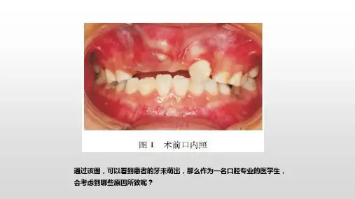 口腔颌面部肿瘤病理—口腔颌面部囊肿(口腔组织病理学课件)