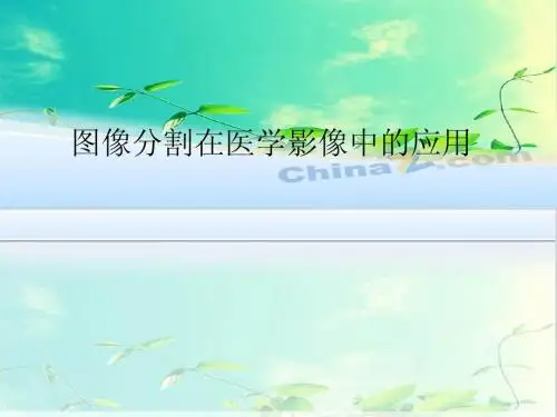 图像分割