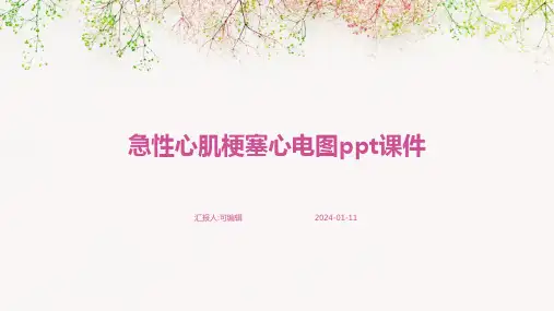 急性心肌梗塞心电图PPT课件