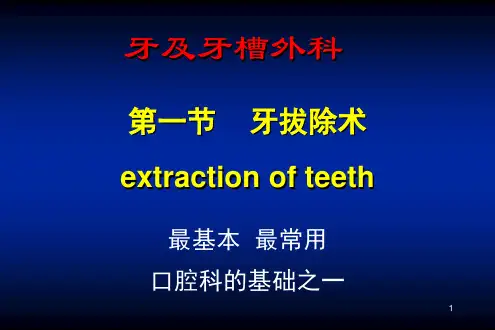 各类牙拔除方法PPT教学课件
