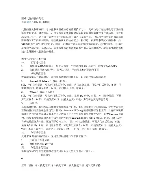 困难气管插管处理