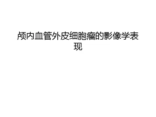 【资料】颅内血管外皮细胞瘤的影像学表现汇编