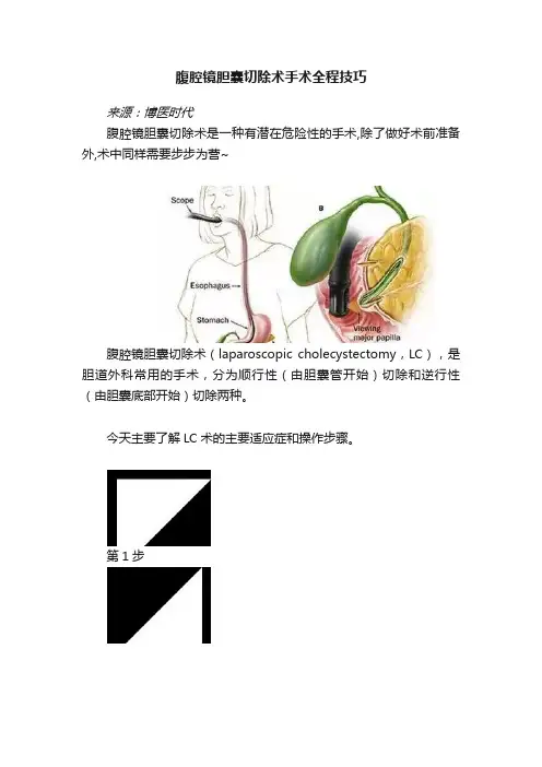 腹腔镜胆囊切除术手术全程技巧